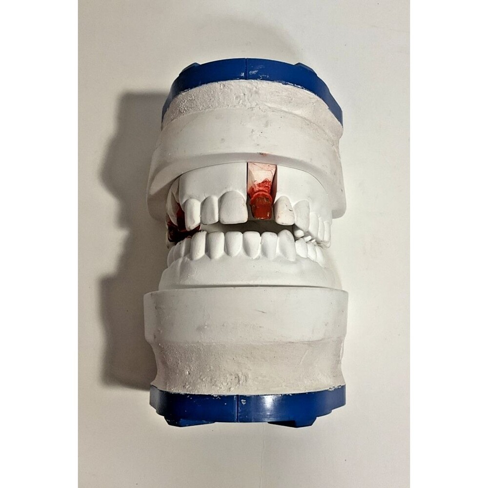 Dental Crown Art Practice Models Typodont